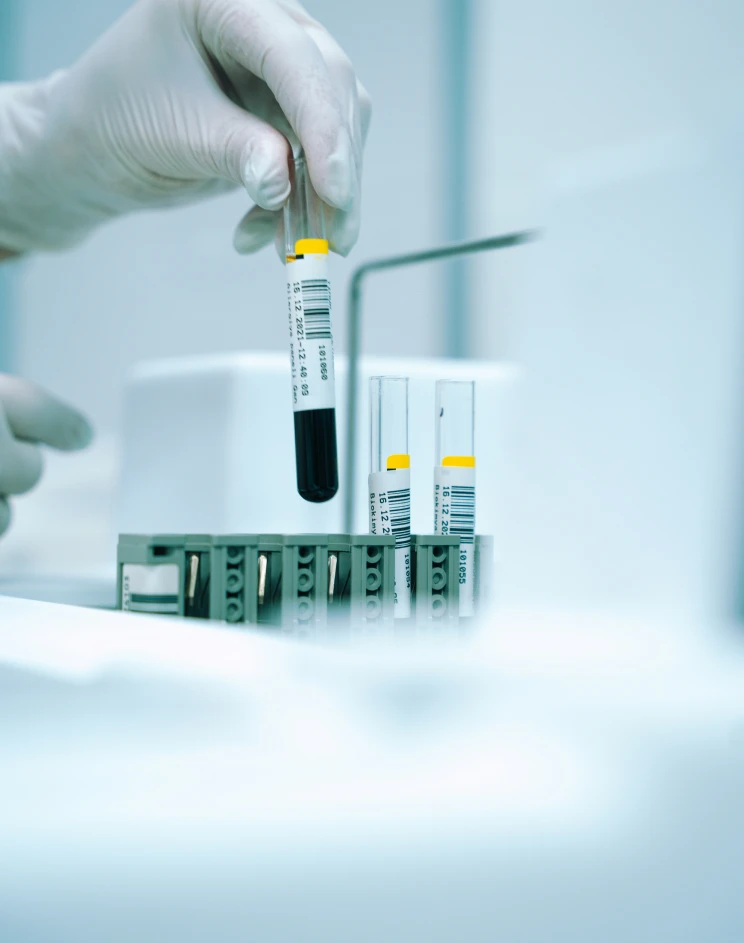 Epigenetik Yaşlanma Testi Fiyatı